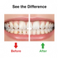 Smart Water Flosser Teeth Cleaner For Cleaning Teeth